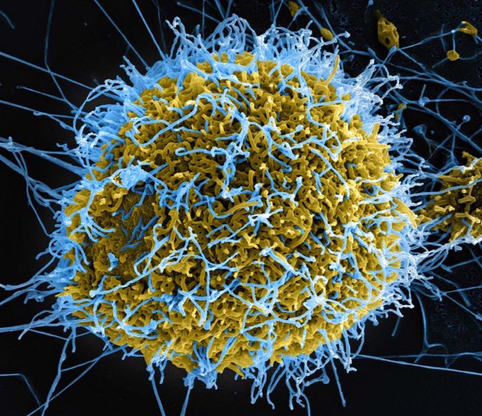 Resurgence Of Ebola Virus Disease: Symptoms, Transmission And Prevention